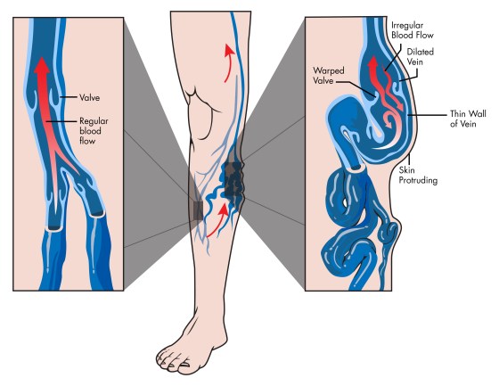 Vein_Anatomy_112