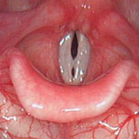 Not mine, but they looked a lot loke this.